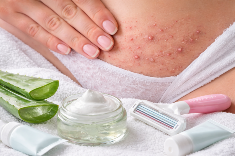 Rasierer, Aloe Vera und Pflegeprodukte auf weißem Handtuch helfen, Rasierpickel vermeiden zu können